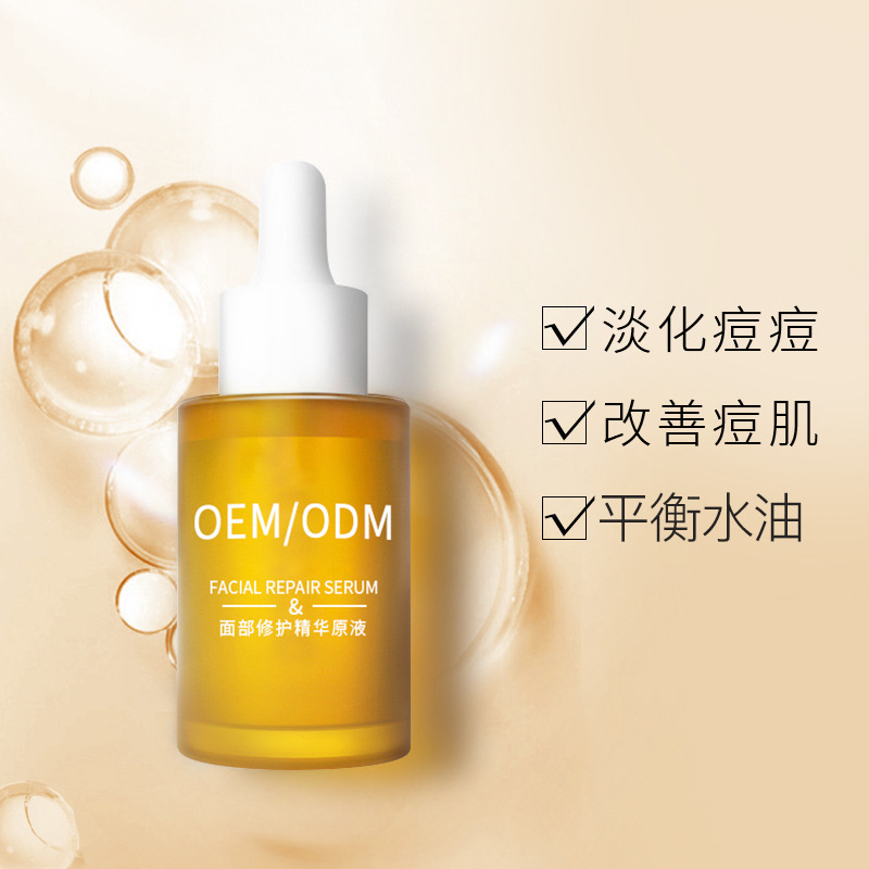 黑龙江_祛痘精华原液OEM